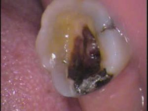 20150803152434_cpt-ipad1