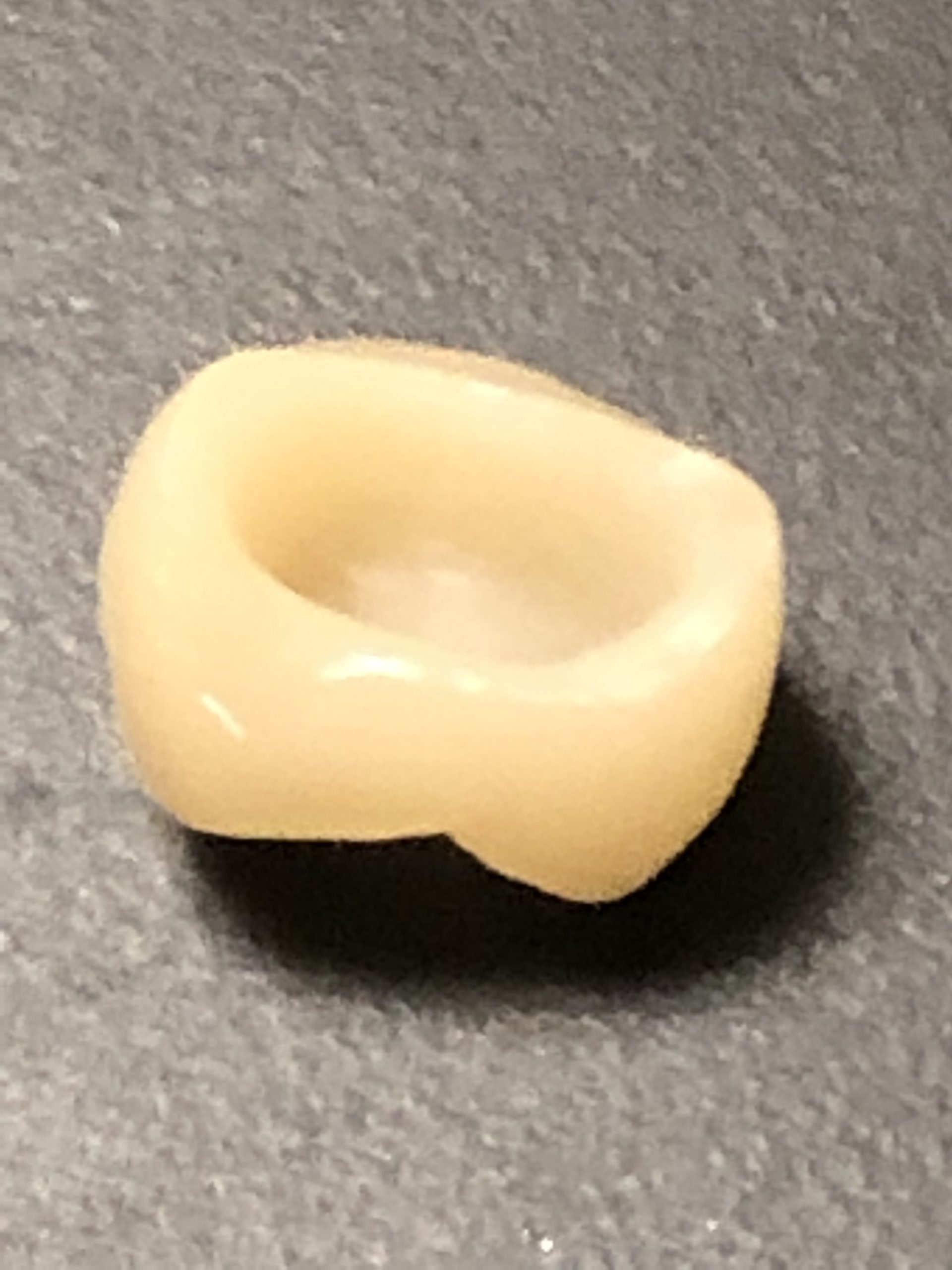 墨田区のみなさん、前歯も保険適用のCAD/CAMでできるようになりました