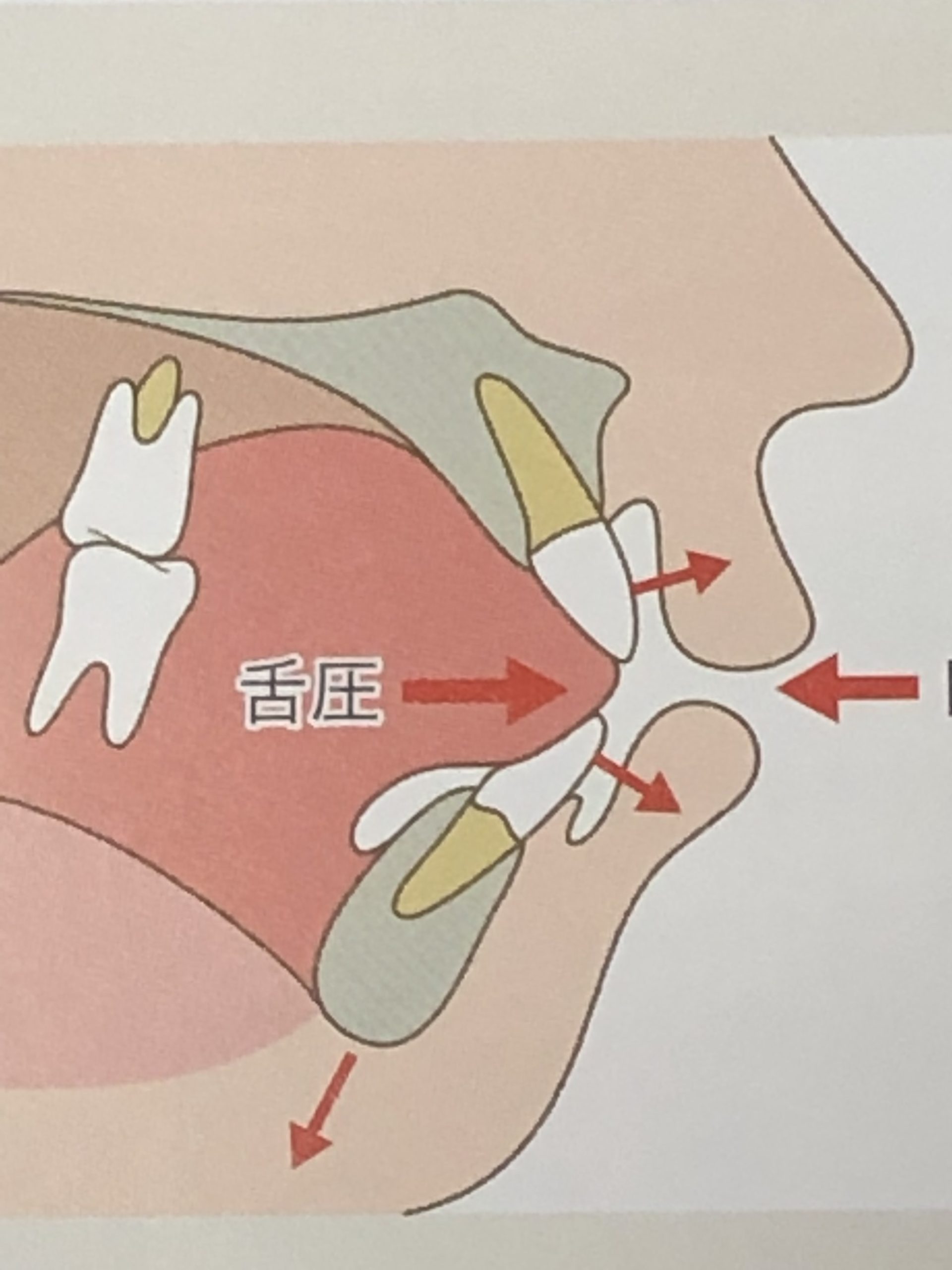 歯があるのに噛めない!